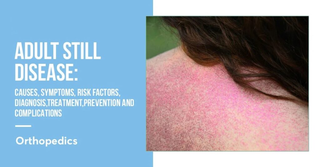 Adult Still Disease :- Symptoms, Causes,risk Factors, And Complications