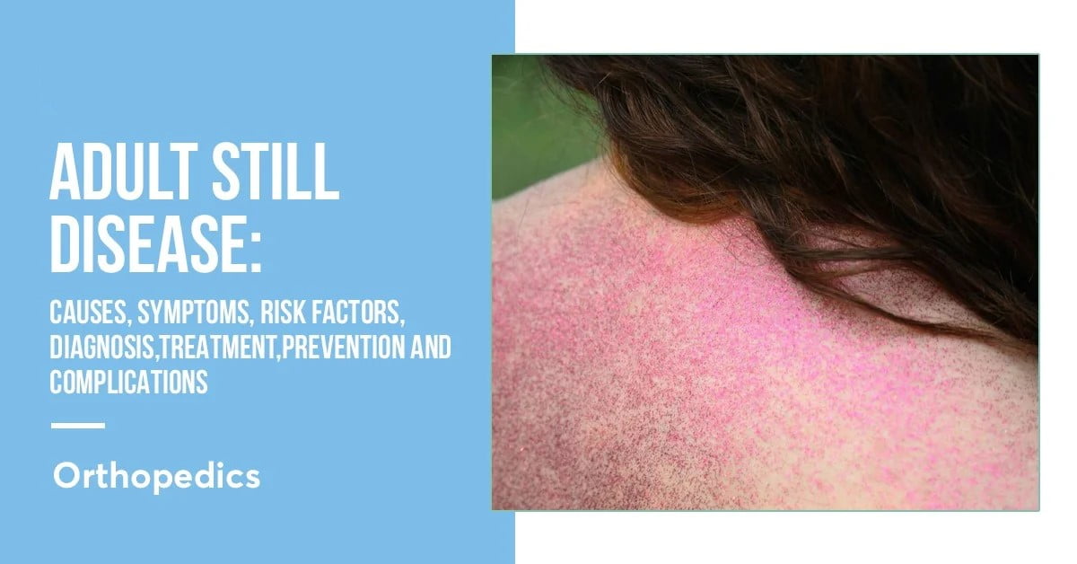 Adult Still disease :- symptoms, causes,risk factors, and complications