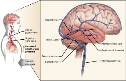 transient global amnesia, transient global amnesia nhs, transient global amnesia icd 10, how to avoid transient global amnesia, drugs that cause transient global amnesia, what is transient global amnesia, transient global amnesia statin, long-term effects of transient global amnesia, most common cause of transient global amnesia, transient global amnesia uk, transient global amnesia treatment, transient global amnesia causes, transient global amnesia symptoms, transient global amnesia cks, transient global amnesia driving, transient global amnesia radiology, transient global amnesia dvla, transient global amnesia attack, transient global amnesia and driving, transient global amnesia aspirin, transient global amnesia and dementia, transient global amnesia alcohol,